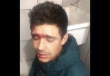 Ladrão trapalhão atira na própria cabeça durante assalto a farmácia