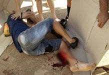Ciclista tem perna dilacerada após ser atropelado por motorista bêbado