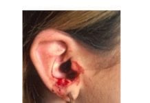 BRUTAL – Mulher sangra pelo ouvido após ser surrada por marido