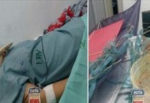 Mulher quase morre após linha de pipa com cerol cortar seu pescoço em Vilhena