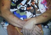 Idosa de 63 anos é agredida por genro em Porto Velho