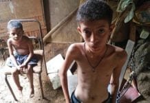 As imagens da tragédia da fome entre crianças na Venezuela
