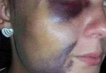 Mulher surrada tenta evitar prisão do marido
