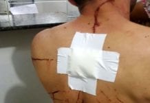 Porto Velho – homem é esfaqueado ao reagir assalto