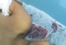 CASTIGO – Suspeito atira no próprio braço durante roubo em comércio