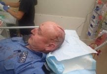 Policial fica com dois cortes profundos na cabeça após ataque com espada samurai