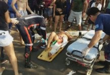 GRAVE: Mulher sofre fratura exposta em violento acidente