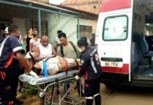Mulher sofre fratura exposta na perna em acidente