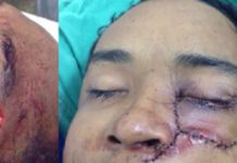 Estudante tem o rosto desfigurado por touro de 300 kg durante treino de montaria em Rondônia
