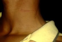 Adolescente arromba portão, invade residência e espanca namorado