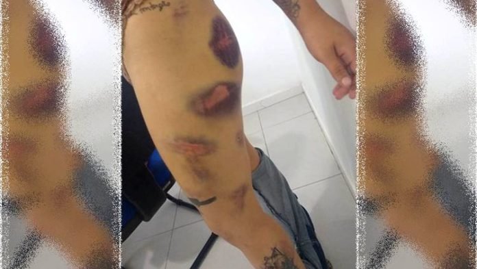 tortura2