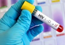 ONG pede à África do Sul que legalize prostituição para combater HIV