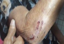 Ex-policial militar foge após agredir e arrastar mãe idosa pelos cabelos