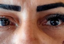 Mulher sofre lesões nos olhos após colocar cílios postiços em clínica de estética de Porto Velho