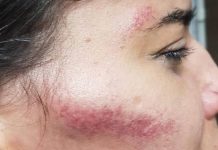 Mulher é acusada de se oferecer para outro homem em festa e é surrada por marido