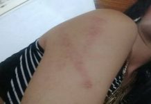 PM prende marido que agrediu mulher a cadeiradas após discussão em casa