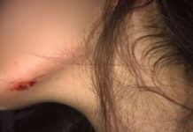 Marido tem crise de ciúmes e surra mulher com socos, chutes e puxões de cabelo