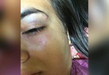 Sob efeito de drogas, homem invade casa e ataca ex-mulher com socos no rosto