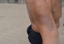 Marido é agredido a paulada e cadeirada pela mulher ao chegar tarde em casa
