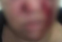 Policiais flagram jovem agredindo homem a cadeiradas na frente de residência