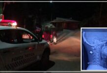 Motociclista é atingido na nuca por bala perdida após tiroteio em Porto Velho