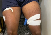 Homem é preso ao tentar embarcar com mais de 3 kg de cocaína colado no corpo em aeroporto de Porto Velho