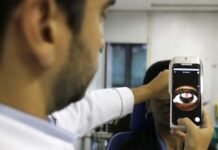 Conselho Brasileiro de Oftalmologia faz recomendações a atletas
