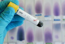 Nova variante do HIV é detectada na Bahia, no Rio de Janeiro e no Rio Grande do Sul