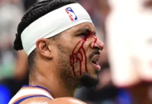 Jogador dos New York Knicks fica sangrando após cotovelada