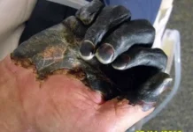 Americano recebe diagnóstico de peste negra após picada de pulga