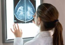 SUS amplia acesso à mamografia a mulheres de 40 a 49 anos