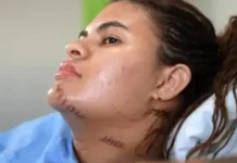 ‘Me fiz de morta’, diz estudante que teve as mãos amputadas em ataque com foice no Ceará